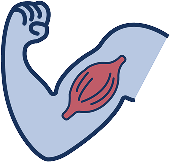 Illustration of arm muscle with dystrophin